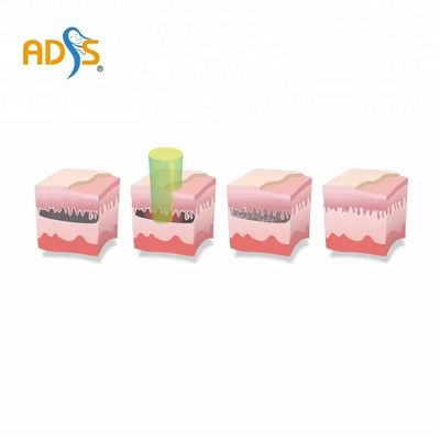 Máy Laser ND YAG xung dài Máy loại bỏ sắc tố bằng laser 1064nm